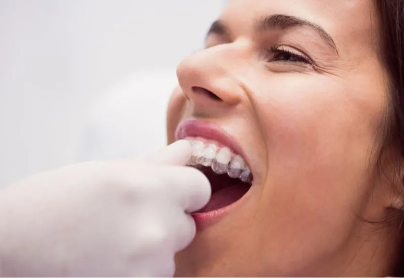 Invisalign in Lahore at surgident