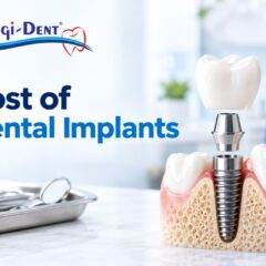 How Much Dental Implant Cost in Pakistan: A Complete Price Guide