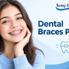 Price of Teeth Braces in Pakistan: Cost of Different Types of Braces