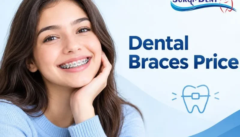 Cost of dental braces